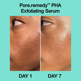Dr.Jart+ Pore·Remedy™ PHA Exfoliating Serum