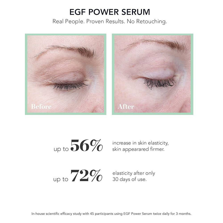 نتیجه مصرف سرم جوانساز پیشرفته EGF بایوافکت BIOEFFECT
