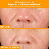 سرم ویتامین سی پائولازچویس