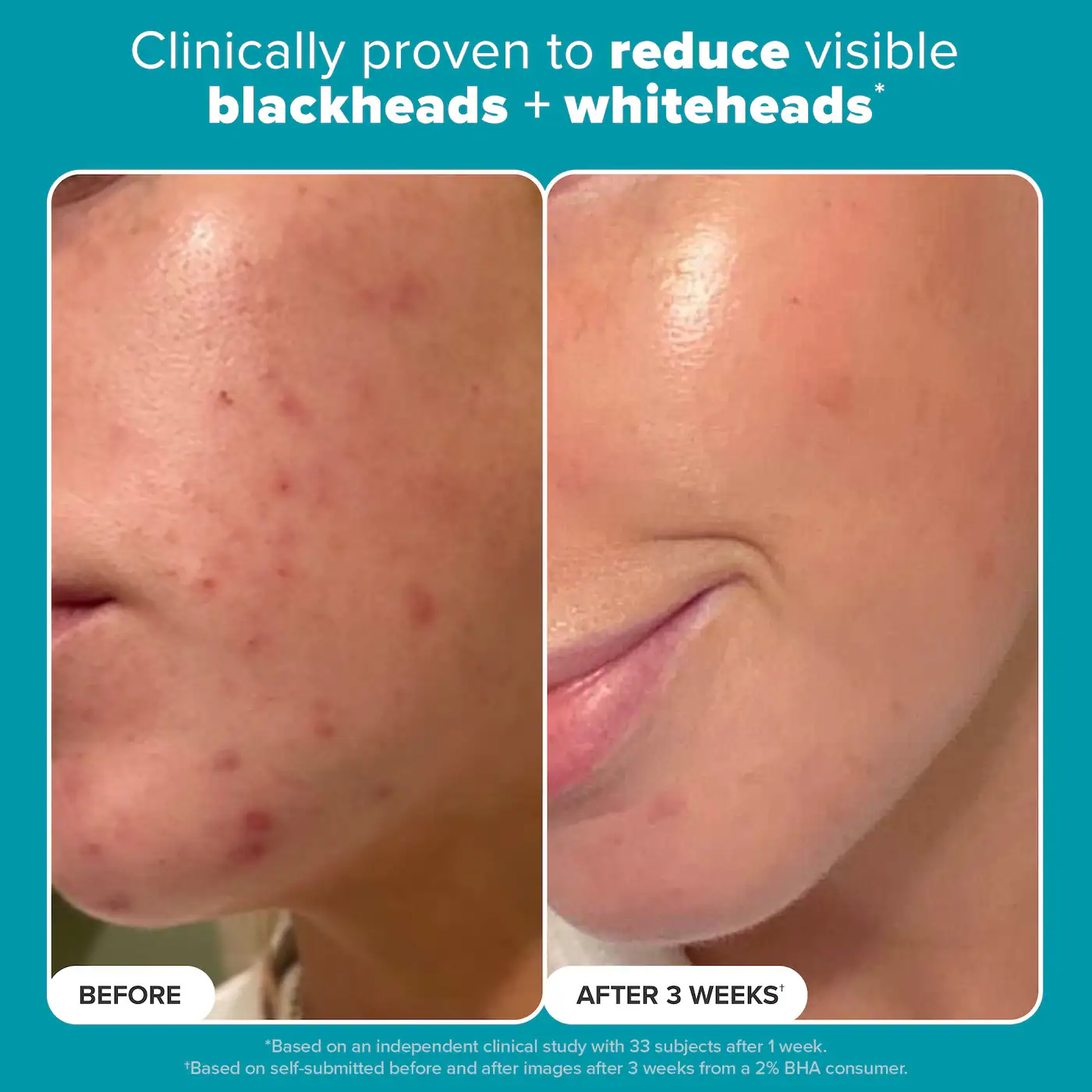 لایه بردار مایع Paula's Choice