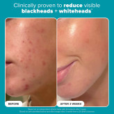 لایه بردار مایع Paula's Choice