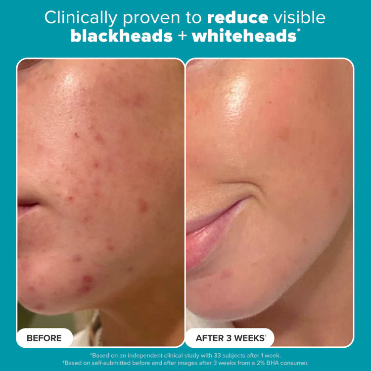 لایه بردار مایع Paula's Choice