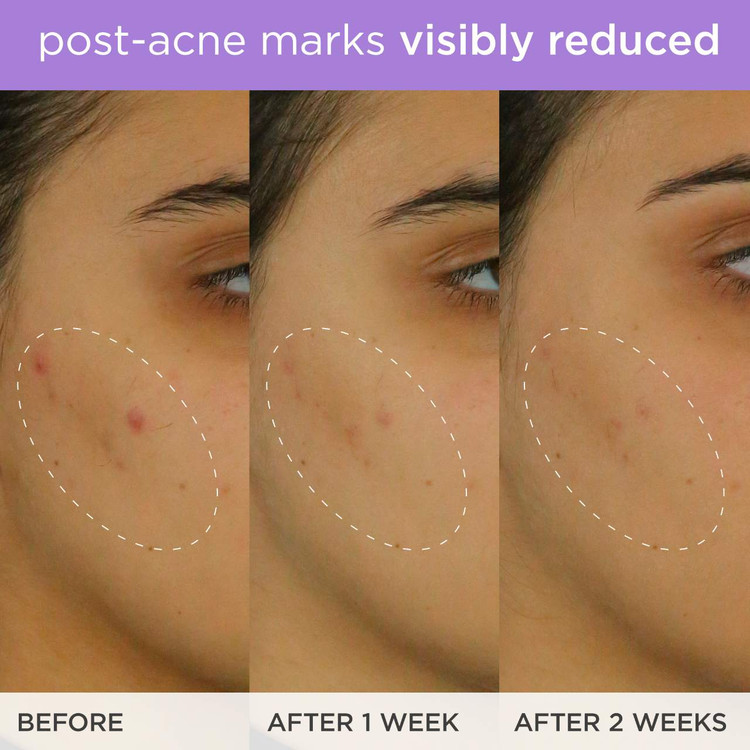 سرم روشن کننده و لیفت ویتامین سی تاچا