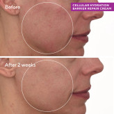 کرم ترمیم کننده موراد murad