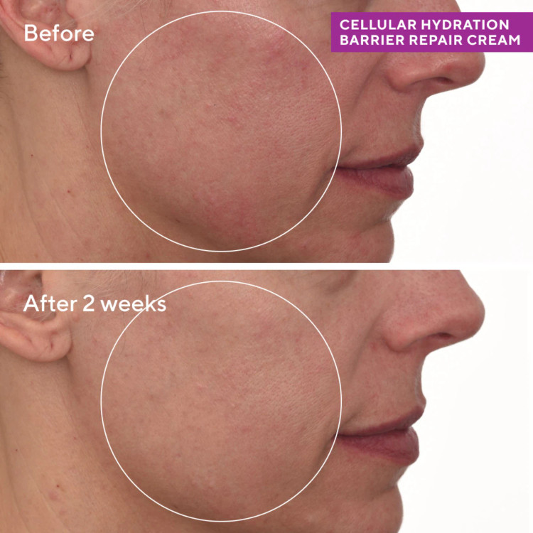 کرم ترمیم کننده موراد murad