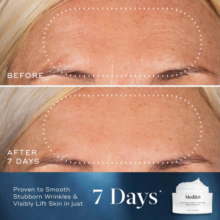 کرم شب مدیکیت