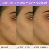 سرم روشن کننده و لیفت ویتامین سی تاچا