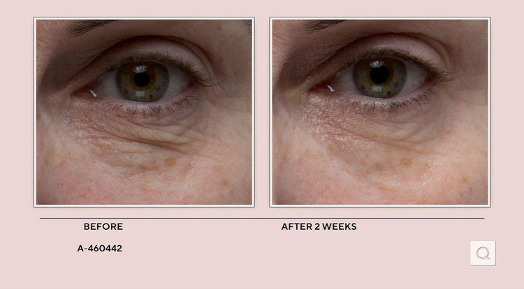 کرم دورچشم پپتاید ELEMIS